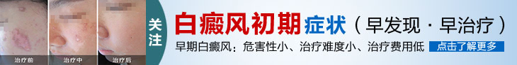 白癜風初期癥狀